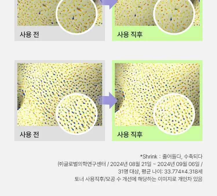 [모공부스터] 마몽드 포어 슈링커 바쿠치올 레티놀 토너 200ml 상세페이지 20